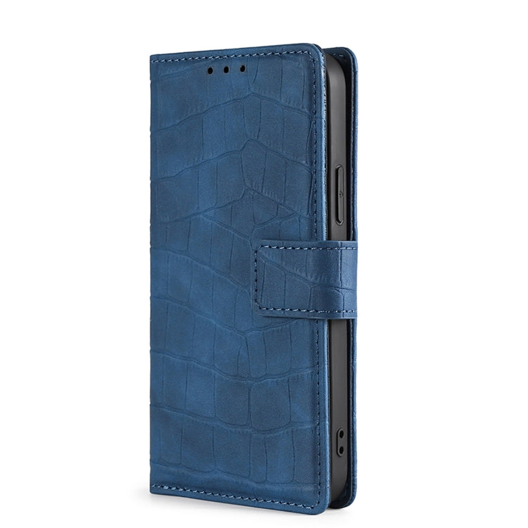 For Doogee X96 Pro Skin Feel Crocodile Magnetic Clasp Leather Phone Case(Blue) - Doogee Cases by buy2fix | Online Shopping UK | buy2fix