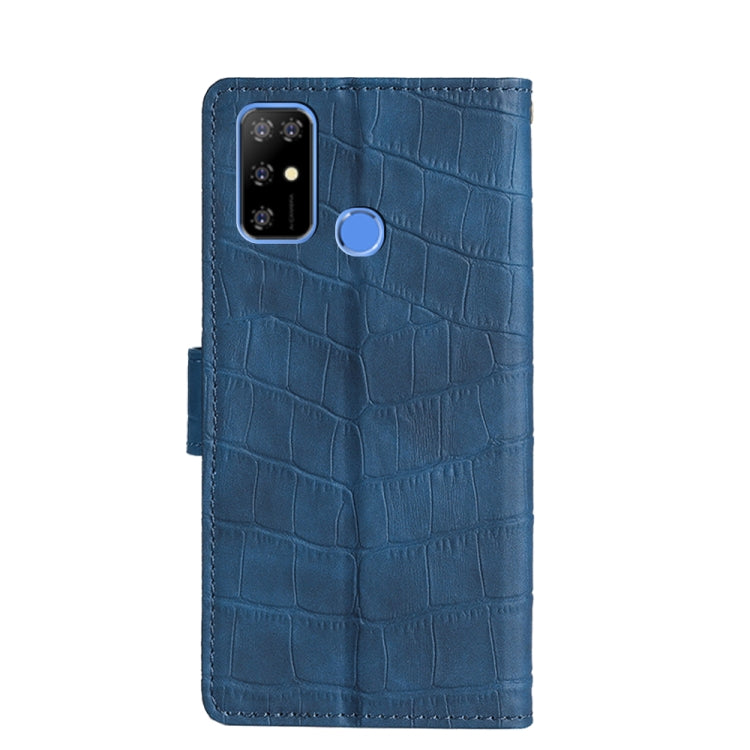 For Doogee X96 Pro Skin Feel Crocodile Magnetic Clasp Leather Phone Case(Blue) - Doogee Cases by buy2fix | Online Shopping UK | buy2fix