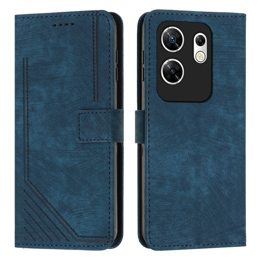 For Infinix Zero 30 4G Skin Feel Stripe Pattern Leather Phone Case with Lanyard(Blue) - Infinix Cases by buy2fix | Online Shopping UK | buy2fix