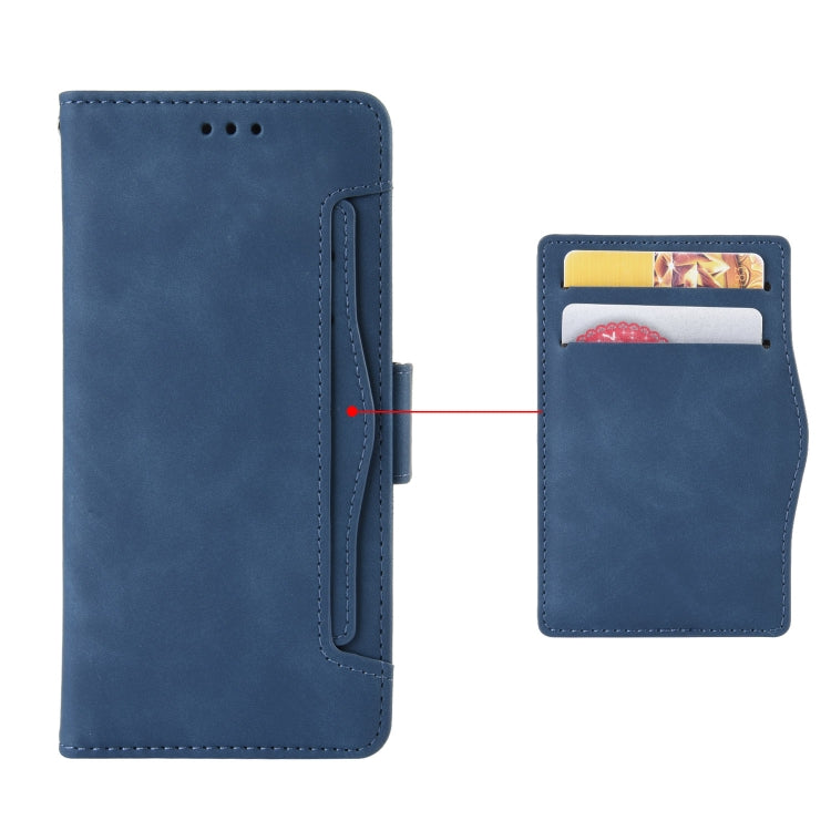 For Doogee X98 Skin Feel Calf Texture Card Slots Leather Phone Case(Blue) - Doogee Cases by buy2fix | Online Shopping UK | buy2fix